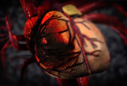 Heart Disease Medical Animation